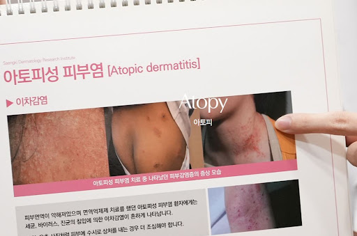 생기한의원 아토피 정보에서 다루는 면역 반응 관련 내용